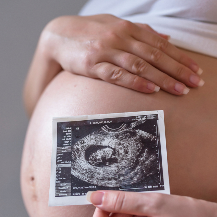 Bump Birth & Beyond: The Complete Antenatal Education Course PLUS